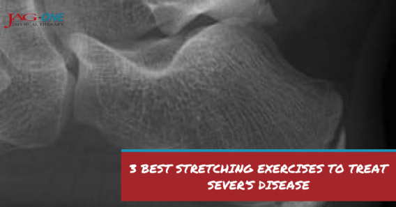 3 Best Stretching Exercises to Treat Sever's Disease
