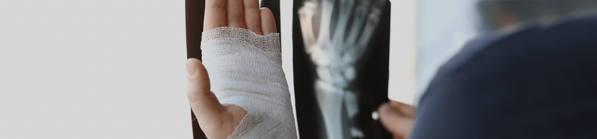 Physical Therapy for Hand and Wrist Fractures